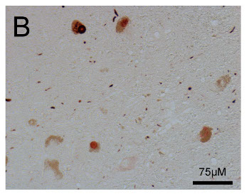 immunolocalization using anti-ASyO5 antibodies